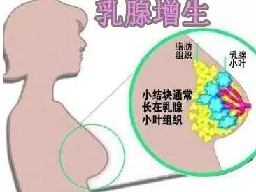 鹿角帽粉对乳腺增生有效吗