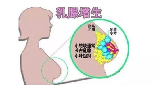 乳腺增生怎么办如何预防乳腺疾病鹿角帽粉有奇效!