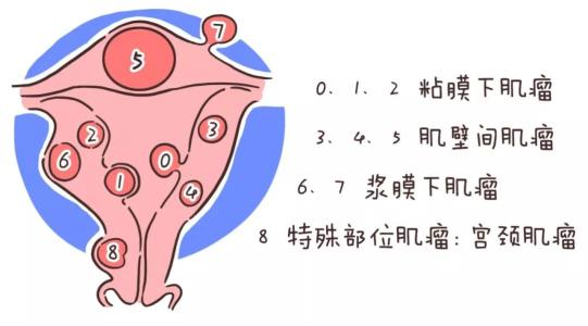 鹿角帽粉治疗患有乳腺增生、子宫肌瘤、子宫囊肿的食用方法