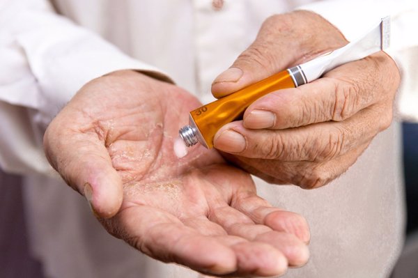 阴茎根部两侧痛