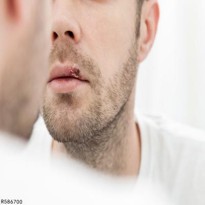 包去长包茎会影响怀孕吗